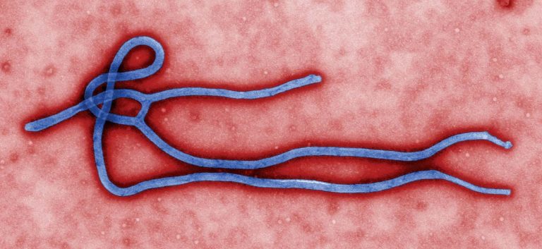 Suspected Ebola case in Abuja tests negative, says FCT Health Secretariat