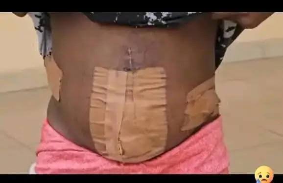 Delta Teen Allegedly Loses Womb After Human Trafficking Ordeal in Ivory Coast